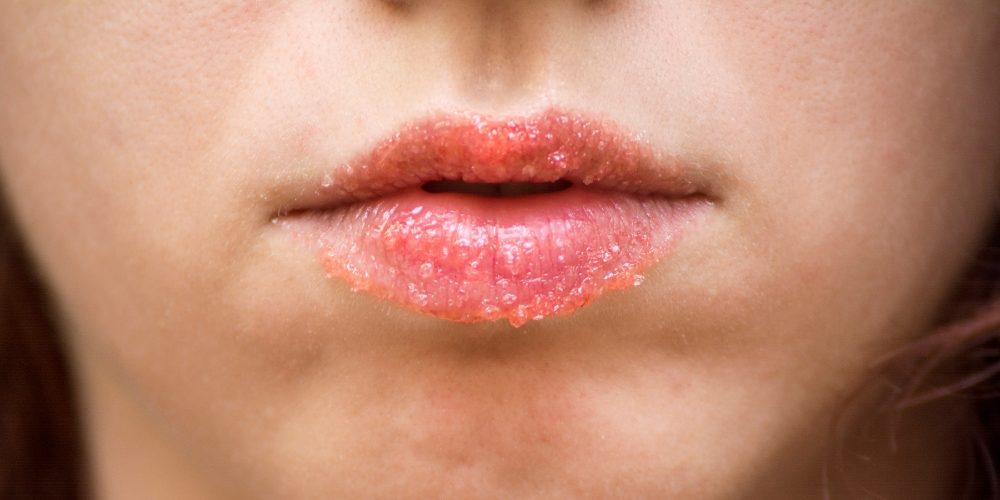 DIY Lip Scrubs for Smooth and Supple Lips: Easy and Effective Recipes